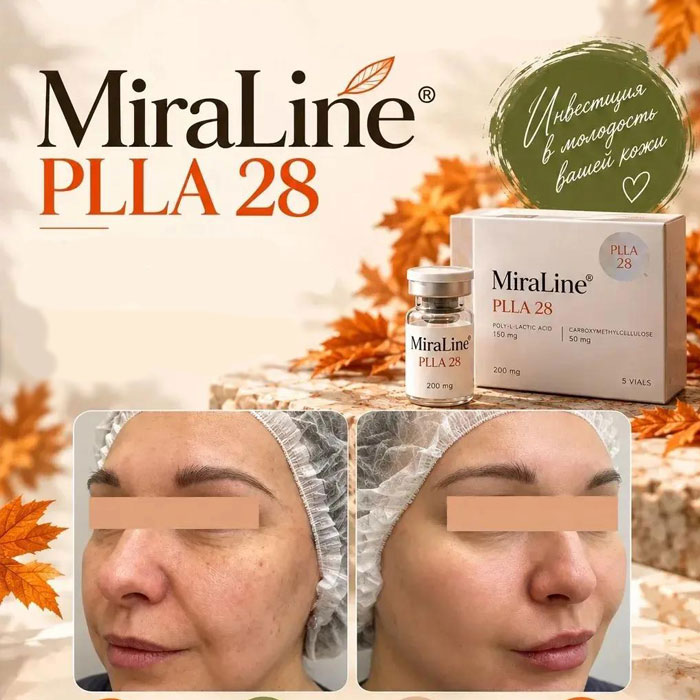 MiraLine PLLA 28