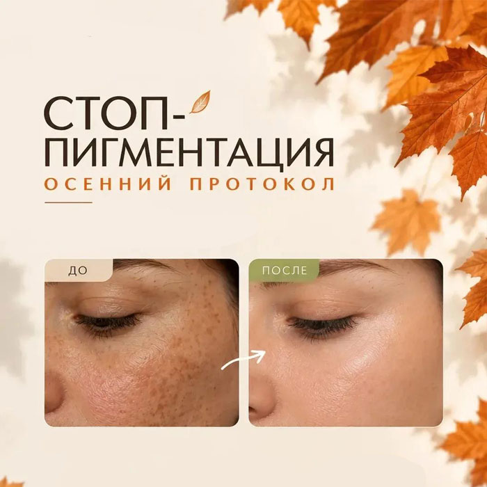 Стоп пигментация